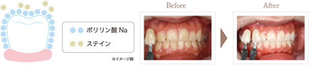 Before After 比較イメージ